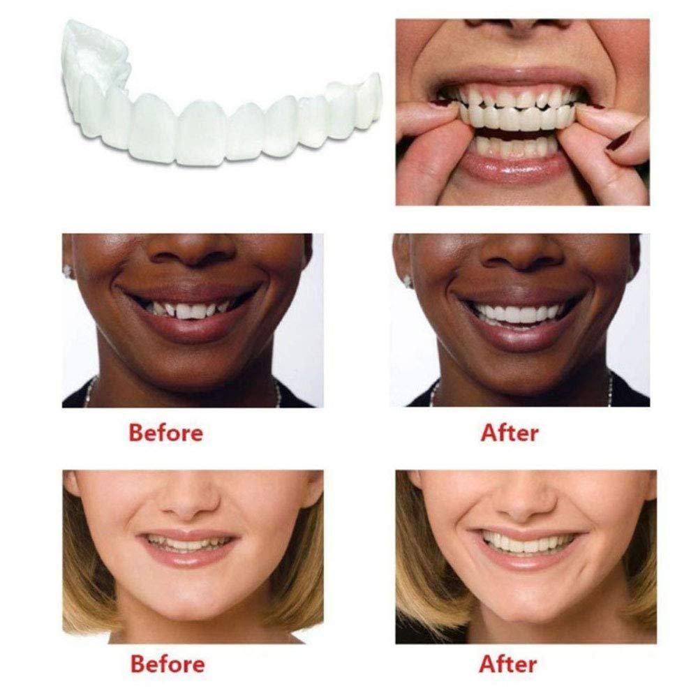 SILICONE ADJUSTABLE SNAP-ON DENTURES(BUY 1 GET 1 FREE)