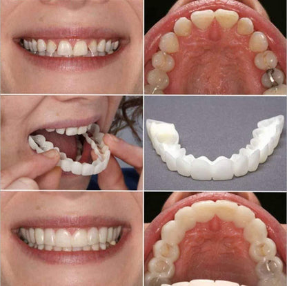 SILICONE ADJUSTABLE SNAP-ON DENTURES(BUY 1 GET 1 FREE)